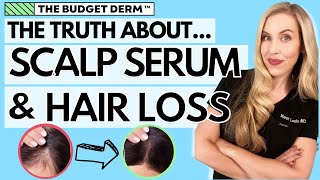 The Truth About Scalp Serums and Hair Loss  The Budget Derm Explains [upl. by Juliano56]