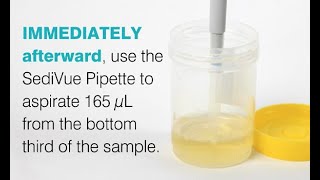 SediVue Dx® Preparing a Sample With a Pipette [upl. by Nathanael]