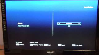 Amiko Mini Combo Receiver  Tune in Saorview Channels [upl. by Oirad620]