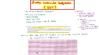 Supraventricular tachycardia  Multifocal atrial tachycardia [upl. by Eelac]