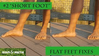 Fix Flat Feet 2 [upl. by Ajat]