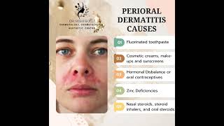 Perioral Dermatitis Causes [upl. by Kciremed]