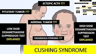 CUSHING SYNDROME  dexamethasone suppression test explained [upl. by Celene]