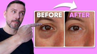 HOW TO MAKE EYE BAGS VANISH IN SECONDS FULL DEMO [upl. by Beltran912]