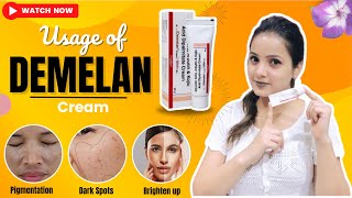 Demelan Cream  Best Pharmacy Cream For Dark Spots and Pigmentation  Glycolic Acid  skincare [upl. by Spark]