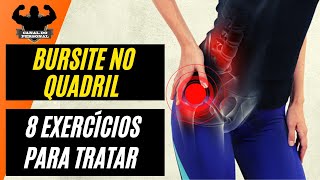 Bursite no Quadril 8 Exercícios para Aliviar e Tratar a Dor [upl. by Marena]