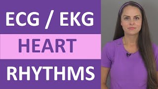 EKG Rhythms  ECG Heart Rhythms Explained  Comprehensive NCLEX Review [upl. by Lindy]