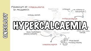 Hypercalcemia in malignancy  causes pathophysiology symptoms treatment [upl. by Pool95]