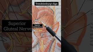 Trendelenburgs Sign  Lower Limb Anatomy [upl. by Yelrak]