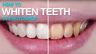 How to Whiten Teeth in Photoshop [upl. by Sinnek748]