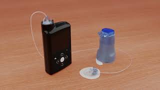 Inserting the Medtronic Extended™ infusion set [upl. by Yrrac]