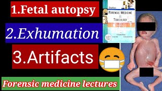 Fetal autopsy lecture exhumation artifacts [upl. by Marven616]