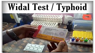 Widal Test procedure and Typhoid [upl. by Stanfill823]