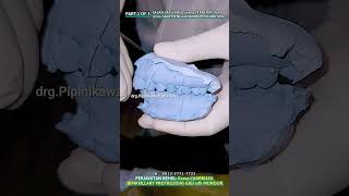 Kasus LUAR BIASA BIMAXILLARY PROTRUSION GIGI sudah MUNDUR  PART 1 OF 3 [upl. by Farant115]