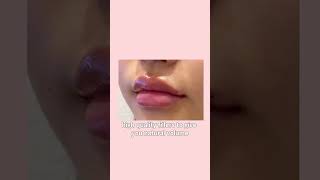 Lip filler 입술필러잘하는곳 [upl. by Trotta745]