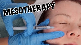 Mesotherapy Facial  Anti Aging Treatment [upl. by Llydnek435]