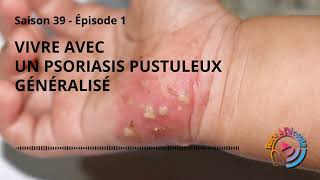 Vivre avec un Psoriasis Pustuleux Généralisé [upl. by Ayojal]