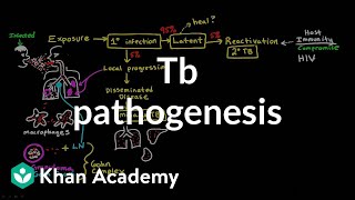 TB pathogenesis  Infectious diseases  NCLEXRN  Khan Academy [upl. by Mima]