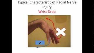 Radial Nerve Flossing [upl. by Cordle]