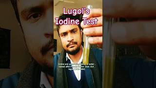 Lugols Iodine test to detect the presence of bile salt in Urine [upl. by Nahsed]