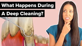 What Happens During a Deep Cleaning Procedure Scaling and Root Planing [upl. by Naerol]