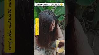 Get Rid of Lice and get Silky Smooth Hair NaturallyNatural Hair Wash Tipsshorts haircare hair [upl. by Airakaz]