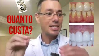 Quanto custa um CLAREAMENTO DENTAL [upl. by Lyndsay]