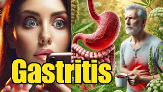 Alimentos que Pueden Ayudar a Aliviar el Malestar por Gastritis [upl. by Zak]