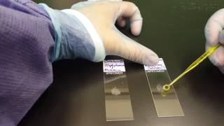 Microbiology the Catalase test [upl. by Etnoel910]