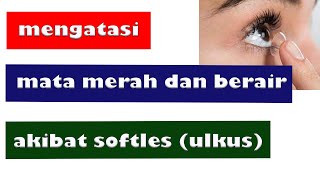 CARA MENGATASI MATA MERAH DAN BERAIR AKIBAT SOFTLENS  ULKUS KORNEA [upl. by Nace341]