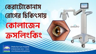 Keratoconus Treatment  Prof Dr Harun Ur Rashid  Dhaka Eye Care Hospital [upl. by Garvey238]