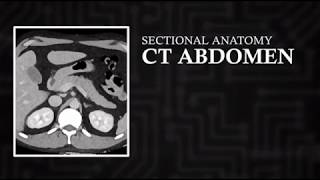 CT Cross Sectional Anatomy Abdomen Axial View [upl. by Morten195]