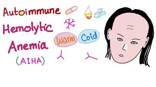 Autoimmune Hemolytic Anemia AIHA  Warm autoantibodies IgG  Hematology [upl. by Ahsakat]