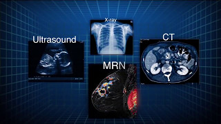 LuciferaseModified Magnetic Nanoparticles in Medical Imaging [upl. by Acinet]