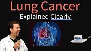 Last Signs of Lung Cancer Before Death [upl. by Nealy718]