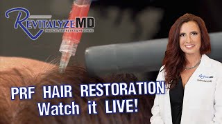 Quick and Easy Hair Restoration with Insane Results  Watch a LIVE PRF Hair Treatment [upl. by Leitman]