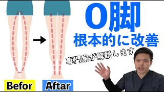 【O脚改善】専門家が解説します。XO脚を根本的に改善させる方法！【埼玉県鴻巣市 〜腰痛治療家 〜高嶺 朝貴】 [upl. by Eislrahc171]