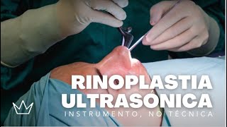 La RINOPLASTIA ULTRASÓNICA 👃 MENOS dolor resultados RÁPIDOS y mejor RECUPERACIÓN [upl. by Shaughnessy676]