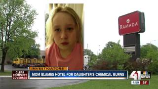 Mom says Ramada Inn pool gave daughter blisters [upl. by Chaker]