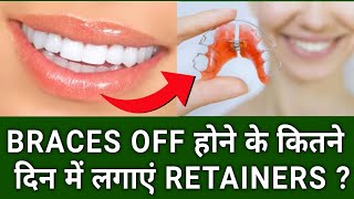 Braces हटने के कितने दिन बाद लगवाएं Retainers  When Retainers after getting Braces off [upl. by Cowey71]