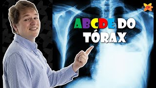 COMO AVALIAR QUALQUER RAIO X DO TÓRAX COM SEGURANÇA O ABCDE DO TÓRAX I VOCÊ RADIOLOGISTA [upl. by Hteb]