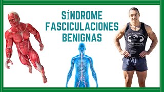 Síndrome de Fasciculaciones Benignas [upl. by Luapsemaj]