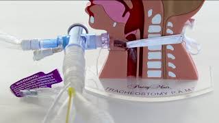 Tracheostomy PAM Ventilator Connections T piece [upl. by Anaitsirc734]