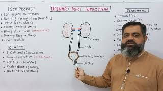 Urinary Tract Infection UrduHindi medium profmasoodfuzailuti utisymptoms utitreatment [upl. by Llemar]