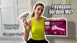 Philips Lumea Almadan Önce Mutlaka İzleyin✨ Prestige IPL BRI950 Modeli İnceleme ve Yorumlarım🌸 [upl. by Lois485]