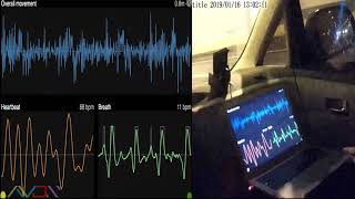 mmWave Radar Vital Sign Detection In Moving Car  Vibration Cancellation [upl. by Kreis]