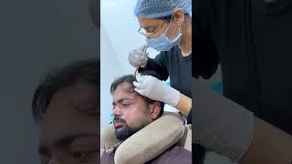 Cara Aesthetics  Hair Transplant amp Skin Care Clinic [upl. by Gilroy157]