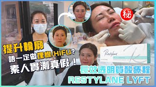 Restylane Lyft 鼻 長效透明質酸療程｜除了埋線療程，還有什麼方法可以提升鼻子或輪廓？｜為什麼推薦使用透明質酸填充劑？｜唯一真實100 素人實測！ medskinhk [upl. by Marmaduke]