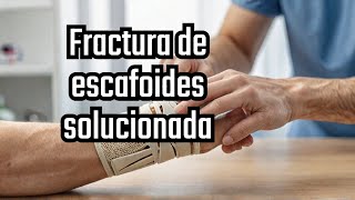 Fractura de escafoides ¿Cuáles son los tratamientos más eficaces [upl. by Cleavland12]