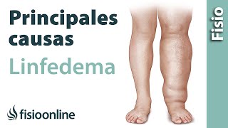 TIPOS de LINFEDEMA y principales CAUSAS 🦵🏻 [upl. by Lyj]